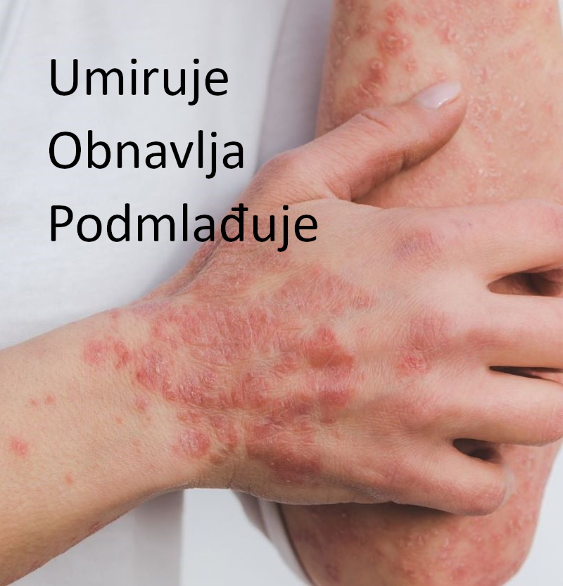 0. Psorijaza slajder